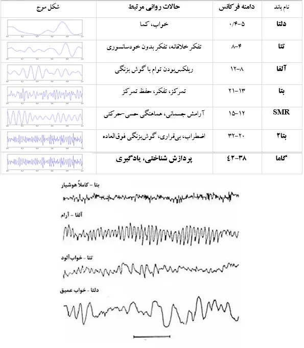 عکس نوار مغز سالم