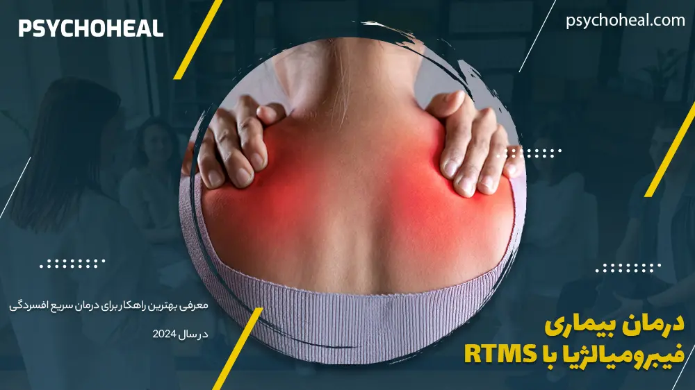 درمان بیماری فیبرومیالژیا (Fibromyalgia) با rTMS