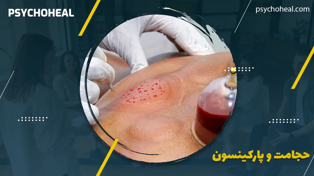 فرد دارای بیماری پارکینسون در حال حجامت