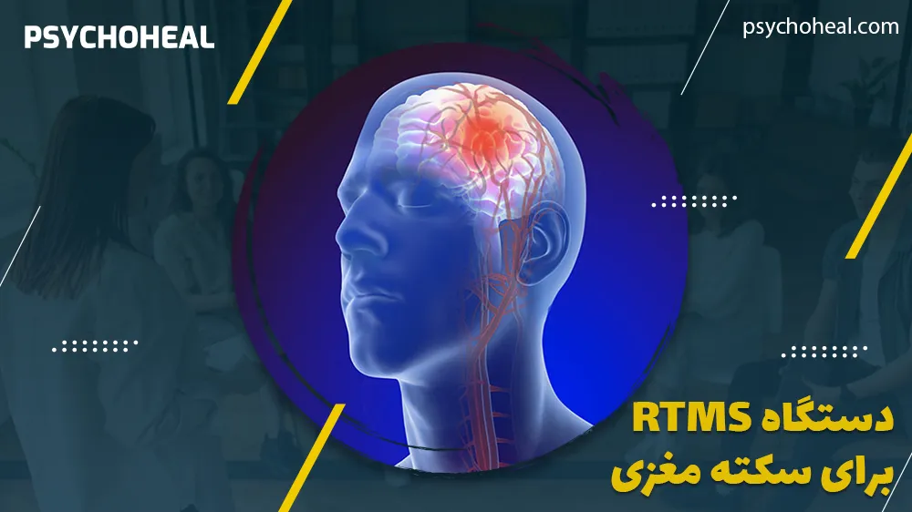 دستگاه rTMS برای سکته مغزی