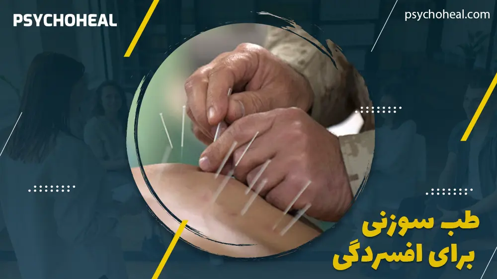 طب سوزنی برای افسردگی